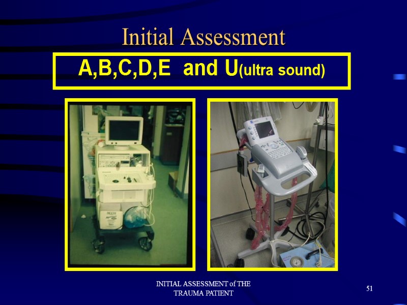 INITIAL ASSESSMENT of THE TRAUMA PATIENT 51 Initial Assessment A,B,C,D,E  and U(ultra sound)